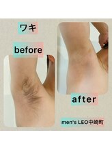 ランドマーク 中崎町(LANDMARK.)/《 ワキ 》