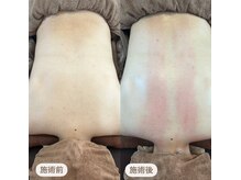 ウーマンビーヘルス(woman Be Health)/リピート続出！！筋膜オイル