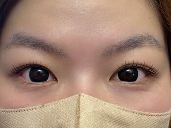 エイジレス(AGELESS)/ポイント→奥行の左右差調整