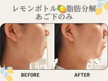 藍/レモンボトル＆プラズマ