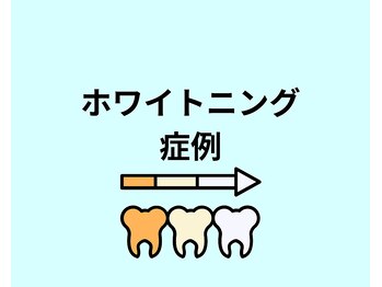カイラニ サロン(Kai lanl salon)/ホワイトニング症例集