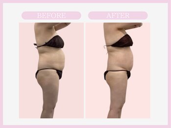 アコガレコガオ 八戸店/