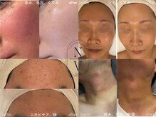 症例はブログ又はフォトギャラリー