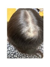 キュライム カブール町田店/気が付いた時が大切です