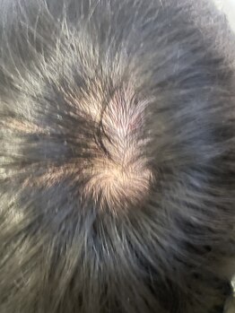 健香癒(けんこうゆ)/頭皮の血流改善