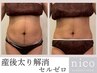 【産後太り解消】ママ応援ダイエット!全身痩身コース¥30,800→