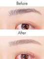 アイム 八王子店(i'm)&nbsp;【Before→After】