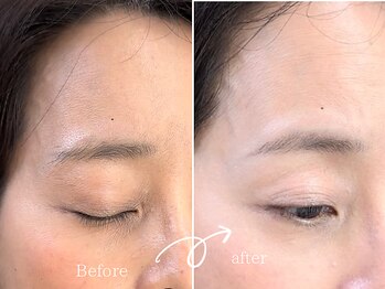 レディゴー(LADY GO)/下がり眉をふんわり眉に♪