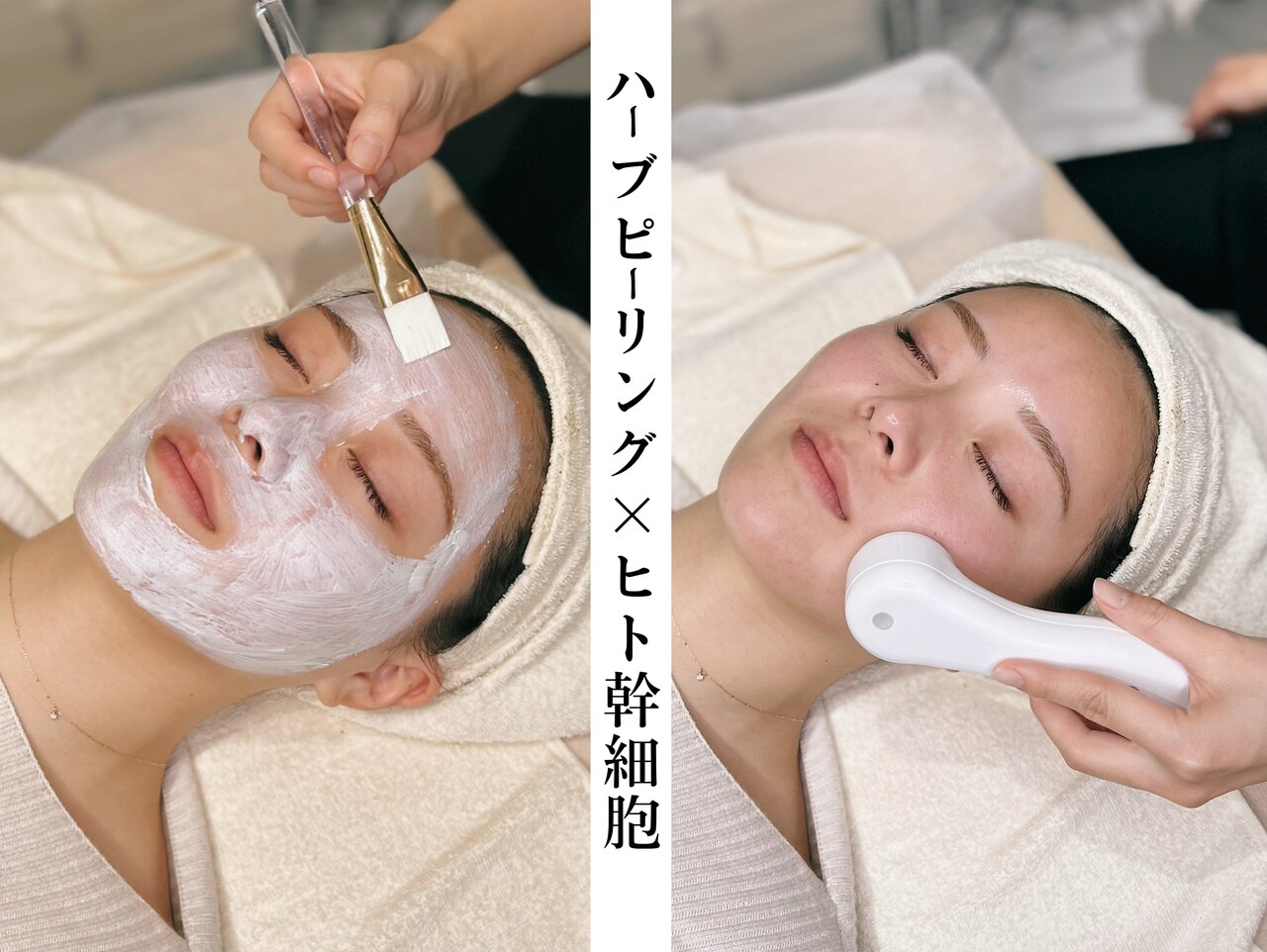 【根本改善&デトックス】剥離なしハーブピ-リング+ヒト幹細胞導入♪ 75分