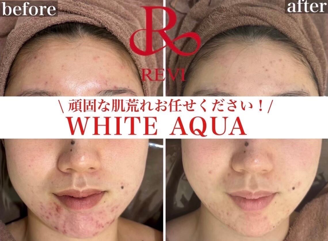 ホワイトアクア 錦糸町店(WHITE AQUA)｜ホットペッパービューティー