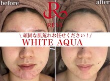 ホワイトアクア 錦糸町店(WHITE AQUA)