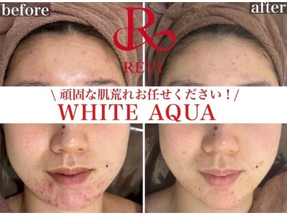 ホワイトアクア 錦糸町店(WHITE AQUA)の写真