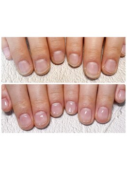 爪の悩みを解消できる（ケア含む）