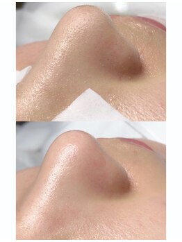 ユミサロン(U Mi Salon)/毛穴レスですっぴんも自信が持て