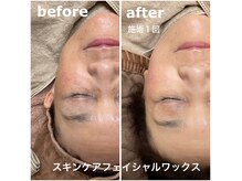 アンドナップ(nap)の雰囲気（あらゆる肌質・症状にきめ細かく応え理想の肌へ♪）