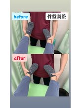 アスミルはり灸接骨院 金山駅前院/骨盤調整後に股関節可動域改善へ