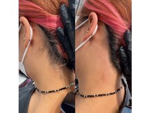 うなじ、フェイシャル脱毛、まゆげパーマもやっています♪
