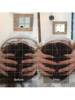 ケーアンド(K&)/《ヘッドスパ》