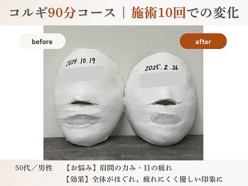 エルマ(elma)/コルギ90分before&after