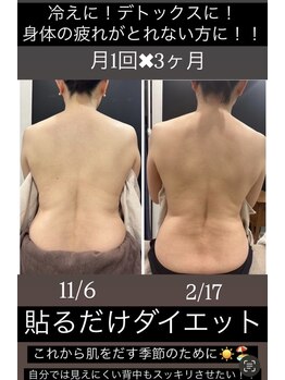 リセラージュ(Recellage)/