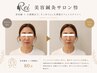 人気No1《ほうれい線・たるみ完全消失◎》Premium美容鍼+小顔矯正