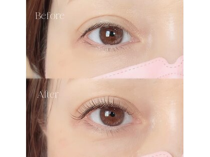 ロイル コア ビューティー(Loeyle core beauty)の写真