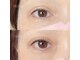 ロイル コア ビューティー(Loeyle core beauty)の写真