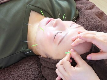 240鍼灸マッサージ院 麻布十番/月に1回の美容鍼で肌質改善