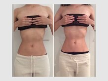 カロン 銀座(Kalon)/【ブライダル腸もみ】1回結果！