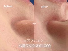 ワクシー 中目黒(WAXYYY.)/小鼻ワックス/黒ずみ解消！