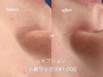 ワクシー 中目黒(WAXYYY.)/小鼻ワックス/黒ずみ解消!