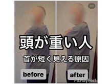 カワル整体 上通り院/首が回らない人