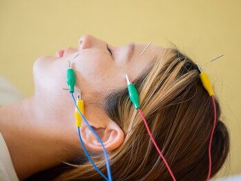 ゆめたか接骨院 鍼灸院 整体院 大沢野院/年齢肌に内側から整える美容鍼◎