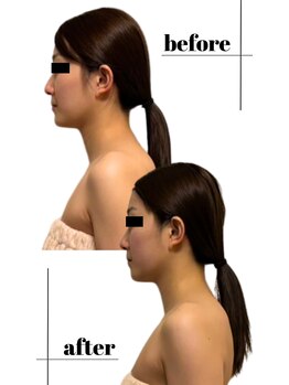 アロマフォーレ 水戸店(AromaForet)/むくみ・冷え◎リンパマッサージ