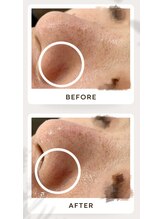 アワイズ(AY's)/しっかり保湿で潤い肌へ！