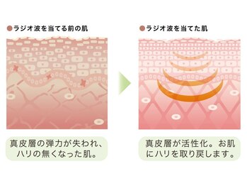 ブリラ(Briller)/当店 RF