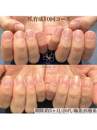 爪育成10コース