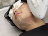 学割U24　大学生・専門学校生対象　ヒゲ全体脱毛　回数：１回　　時間４５分
