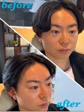 オンリーケア バイ ボーイズビー(ONLY CARE by Boys Be)/bubble毛穴洗浄(全顔)