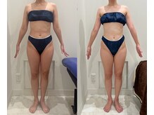 エレン(Elen)/最強ダイエットデトックスコース