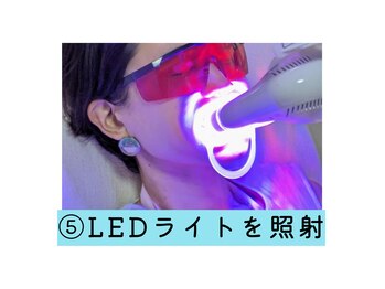 ネージュ(neige)/5.LEDの光を歯に当てる