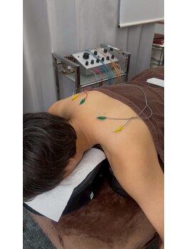 はまの整骨鍼灸院/肩の鍼（こちらは電気鍼）