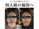 キュープ 高崎店(Qpu)の写真/【小顔頭蓋骨矯正＋オイルケア￥9,900→￥8,400】高濃度酸素オイルでよりスッキリ！より小顔に！