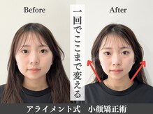 【小顔・姿勢に特化したサロン】美容整体 Alignment TOKYO 横浜の雰囲気（小顔矯正姿勢矯正★横浜駅からのアクセスも良く通いやすい好立地）