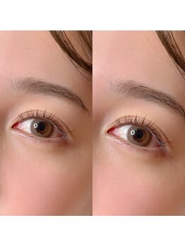 ルネ アオヤマ(LUNE AOYAMA)の写真/大人女性の目元を上品に。初めてのエクステでも魅力を最大限に引き出し、自分史上最も輝くお目元へ。