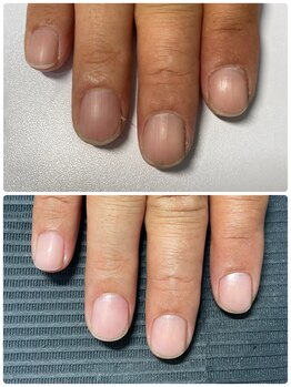 クーラ アンド ベリッシモ(Cura&Bellissimo)/自爪ケア