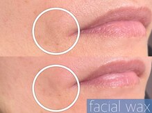 レーヴ(REVE)/フェイシャルワックス（口周り）