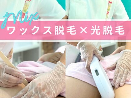 ヴィーナス(Venus)の写真