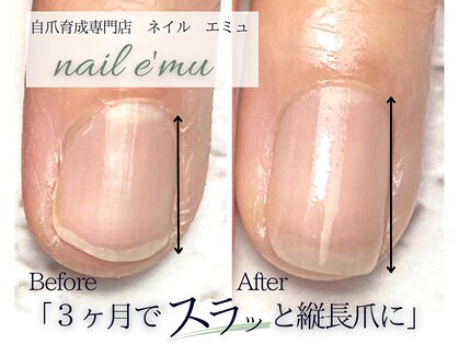 ネイル エミュ(nail e'mu)の写真