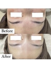 ウルル(ULuLu)/ビフォーアフター